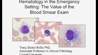 Hematology in the Emergency Setting: The Value of the Blood Smear Exam - conference recording