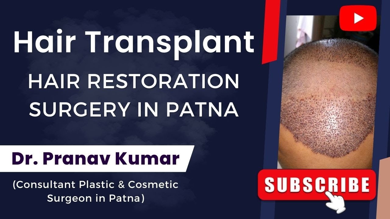 Hair Transplant Hair Restoration Surgery in Patna Dr Pranav Kumar