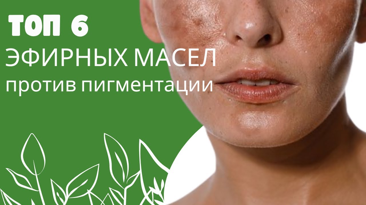 Убери пигментацию на лице. Эфирные масла. Убрать пигментацию без боли