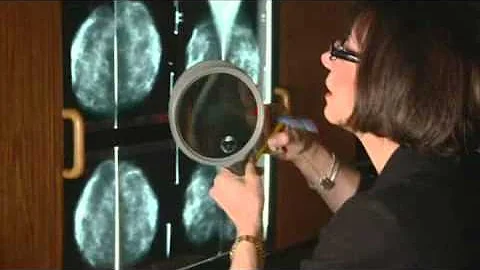 Dr. Paula Gordon on what a radiologist looks for i...