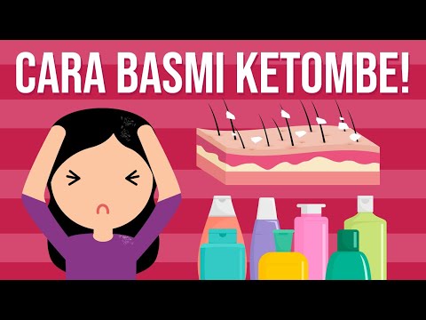 Video: Kulit Kepala Berjemur: Gejala, Pengobatan, Dan Pencegahan