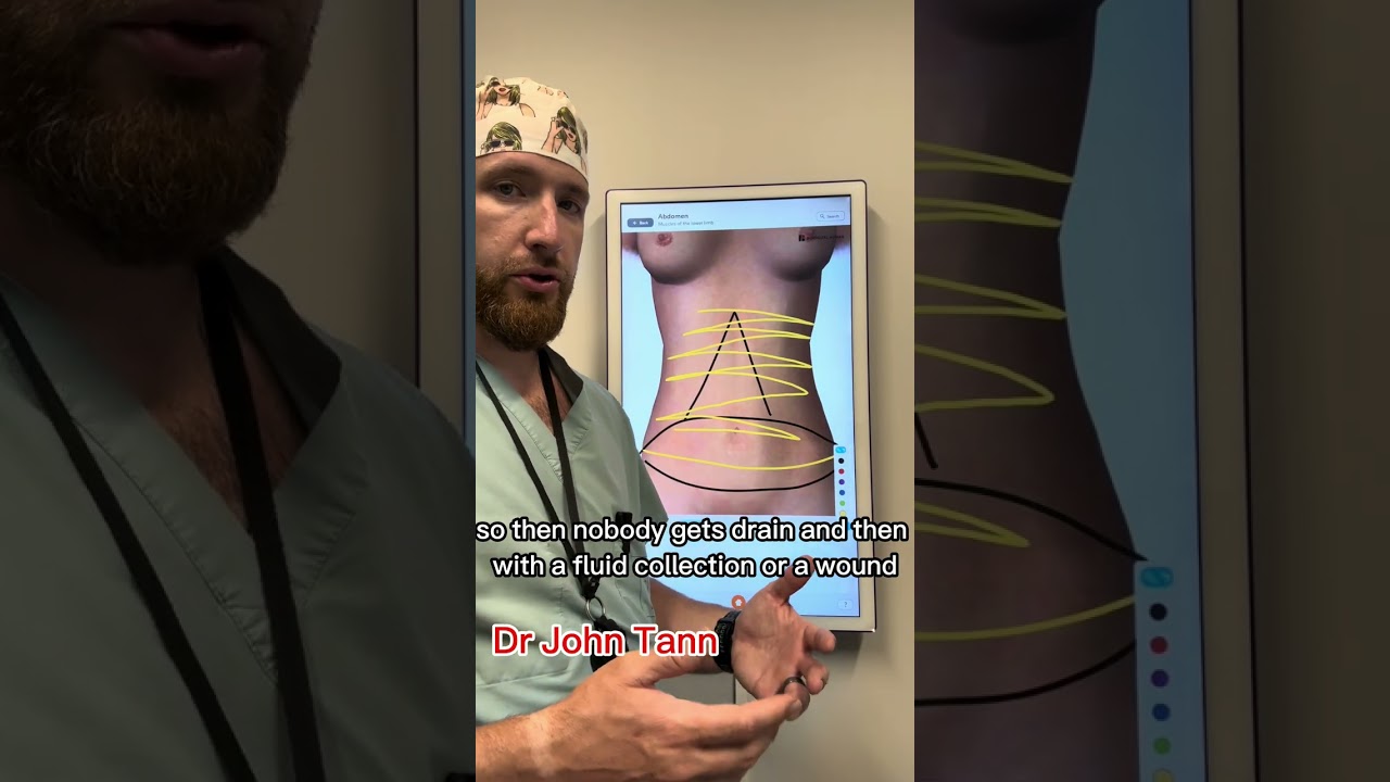 Overview of the Panniculectomy