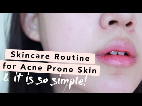 Skincare Routine Guide for Acne Prone Skin • How To Layer Active Ingredients & Oil