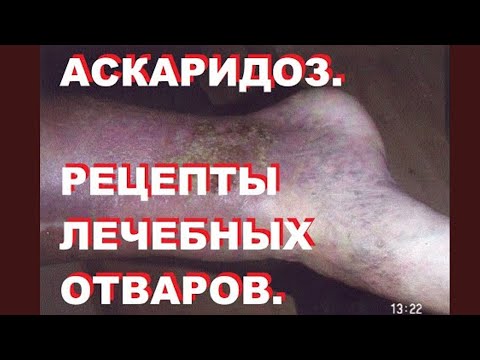 Видео: 