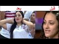 حسناء الزمالك دنيا الحلو قبل وبعد .. مش هتصدق