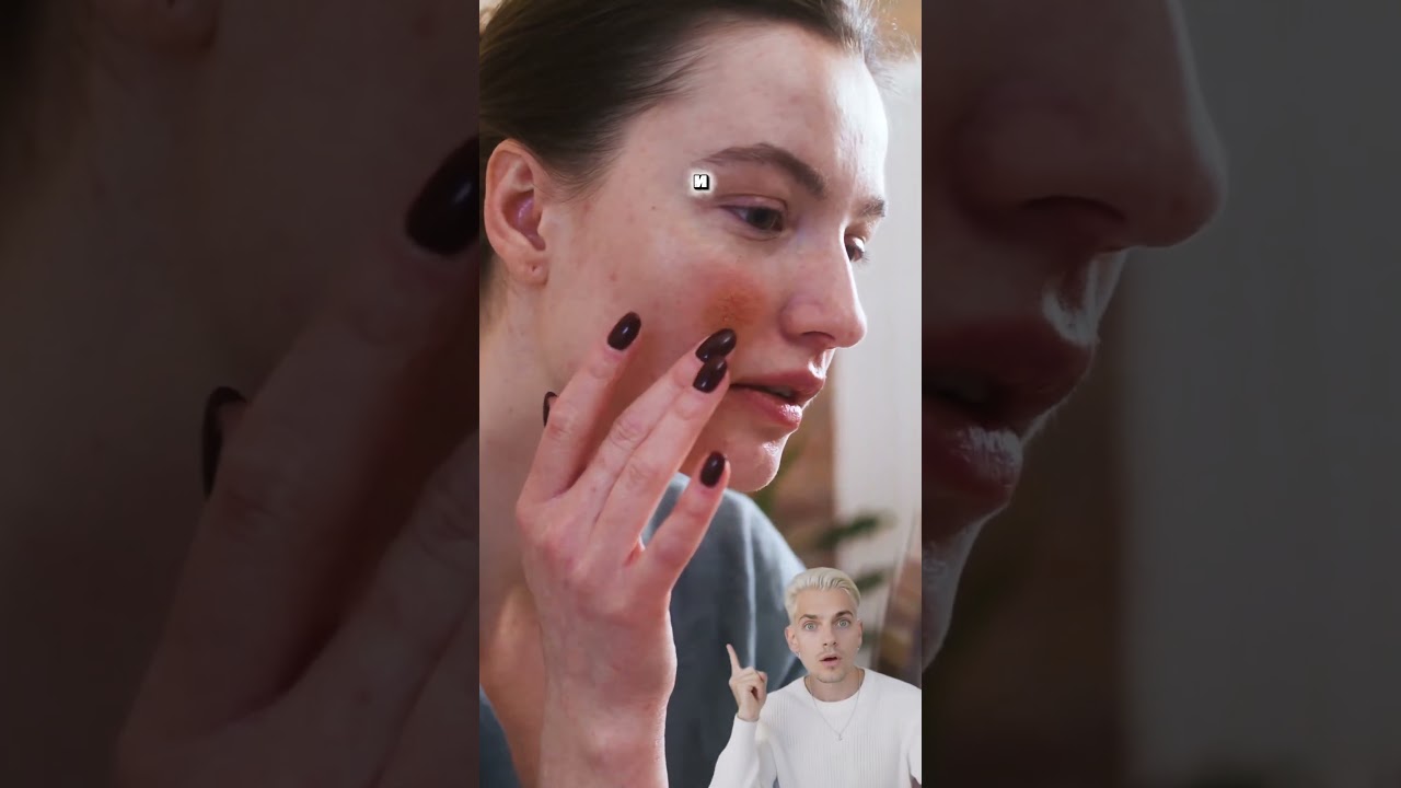 SPF предотвращает пигментацию 