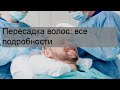 Пересадка волос: все подробности