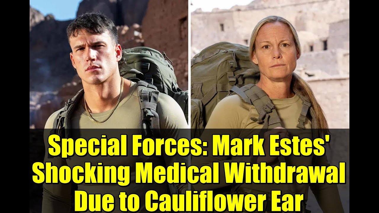 Спецназ: шокирующая отставка Марка Эстеса из-за ушей, похожих на цветную капусту