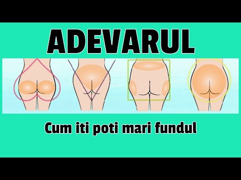 Video: Cum Să Faci Față Unei Coapse