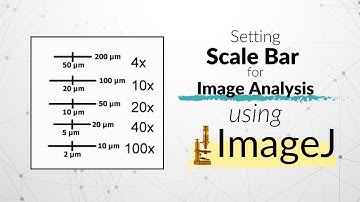 How to set Scale Bar using ImageJ software | Microscope | Imaging  #howto #image