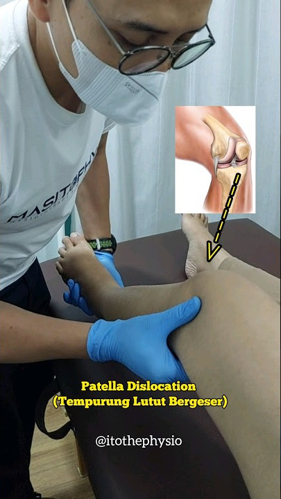 Tempurung lutut bergeser (Patellar Dislocation) #fisioterapi #cedera #manualtherapy #kretekkretek