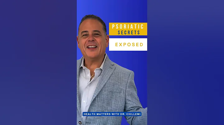 Psoriatic Arthritis: The Hidden Truths