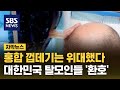 홍합 껍데기는 위대했다…대한민국 탈모인들에게 희소식