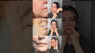 "Erase Smile Lines & Lift Your Face Naturally | Anti-Aging Face Yoga for Glowing Skin 💆♀️Facelift