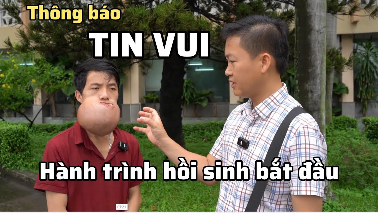 TIN VUI: Em Dìa sẽ được phẫu thuật miễn phí bởi bác sĩ Thái Trung và Bệnh viện tỉnh Bình Dương!