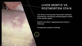 Postmortem Stain Presentation Faith Primm