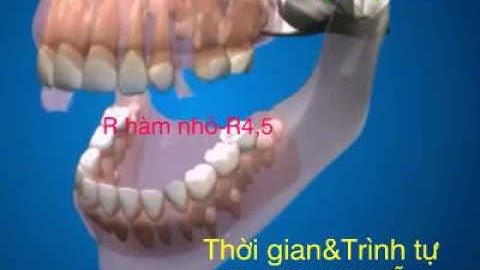 Thời gian và trình tự mọc răng-vietsub