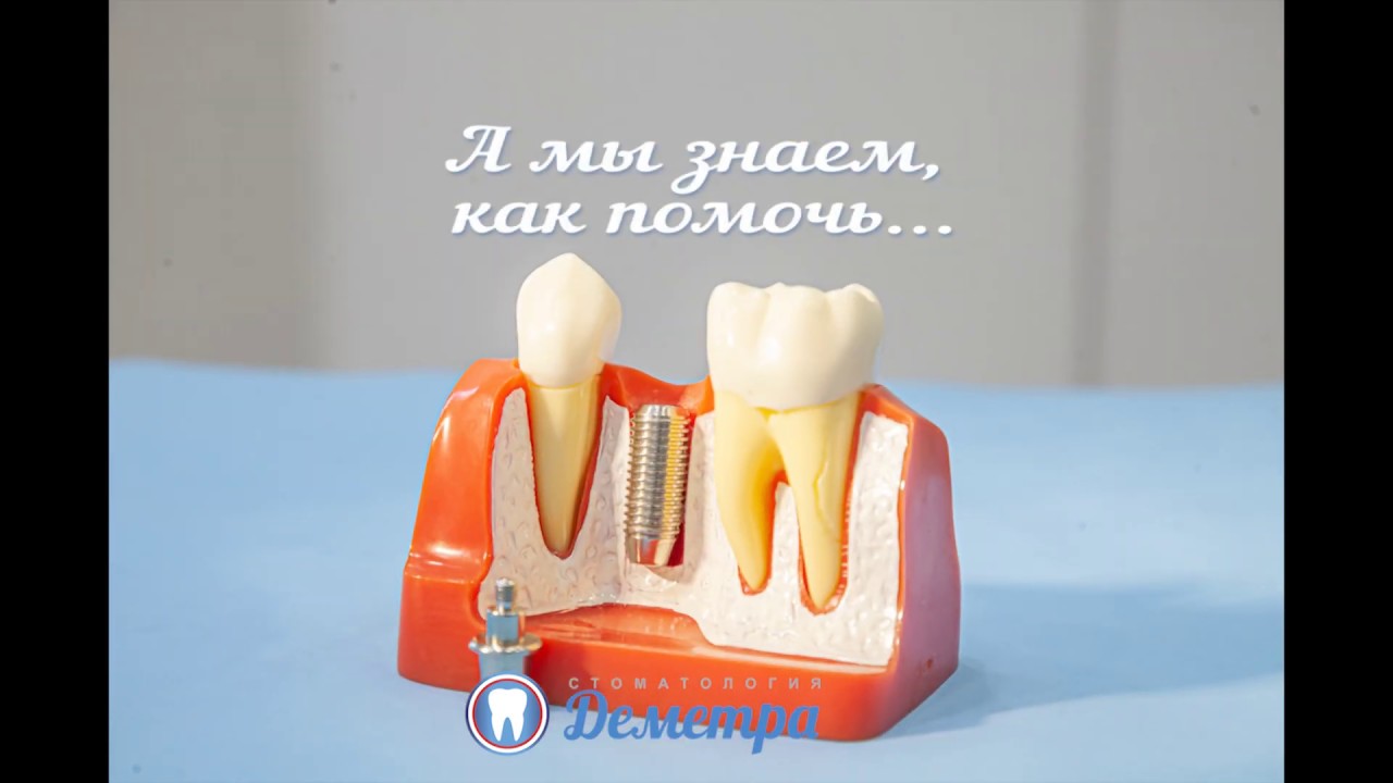 Калина стоматология тюмень
