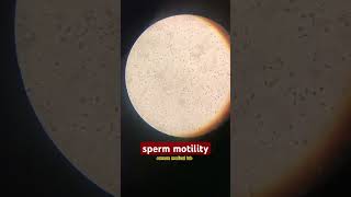 sperm motility religion youtubeshorts medicalmicrobiology microbiology science