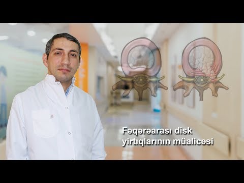 Video: Konstitusiyada filibuster haradadır?