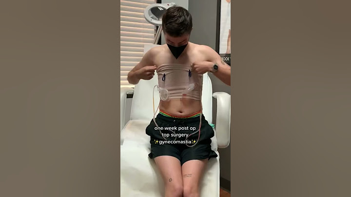 FTM Top Surgery Reveal 🥰