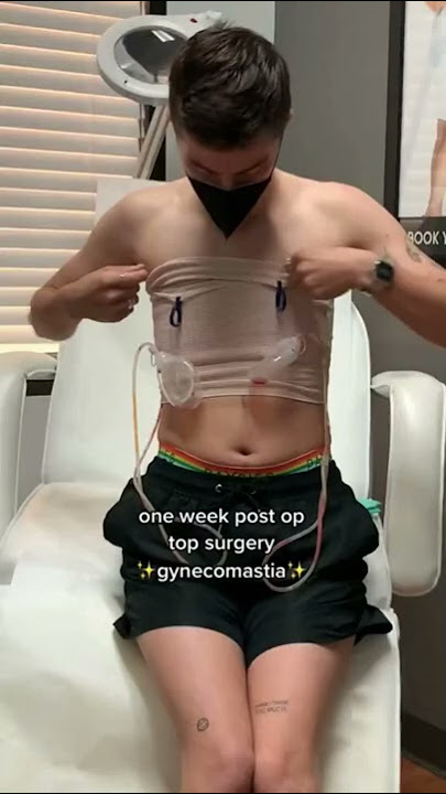 FTM Top Surgery Reveal 🥰