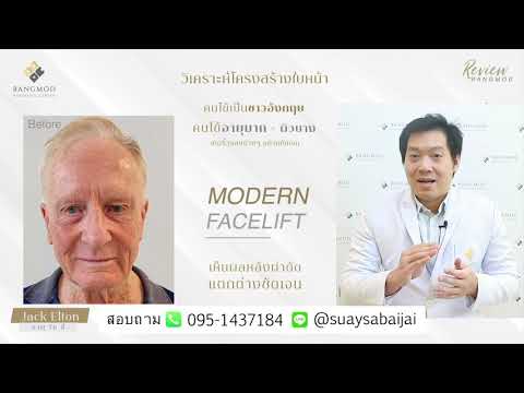 ดึงหน้า l อายุมาก ผิวบาง ดึงหน้าลดอายุ เห็นผลจริงหรือไม่ โรงพยาบาลบางมด