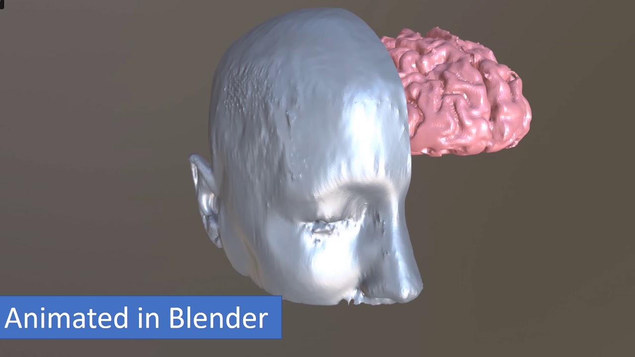 Data Spotlight: The Cancer Imaging Archive