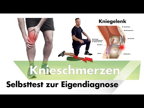 Knieschmerzen unter der Kniescheibe? | Patellaspitzensyndrom Selbsttest | jumpers knee
