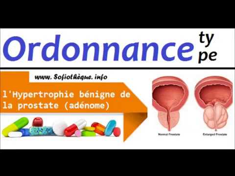 prostate - Traduction roumaine – Linguee