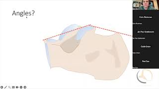 Download Lagu Calcaneus fractures Part 1 Radiographic review and assessment Download Lagu Calcaneus fractures Part 1 Radiographic review and assessment
