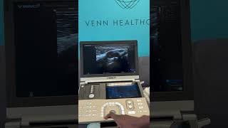 What is the difference between B Mode Vs Harmonic Imaging Vinno V6