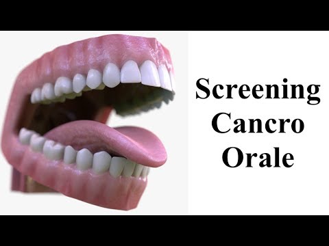 Screening cancro orale - Oral Cancer Screening