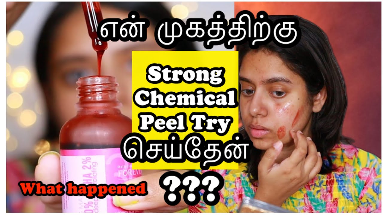 😱Strong Chemical Peel try செய்வதற்கு முன் இதை பாருங்க exfoliation at