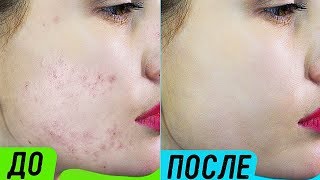 видео В салоне красоты: секреты здоровой кожи