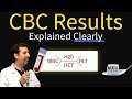 Complete blood count  cbc interpretation leukocytosis
