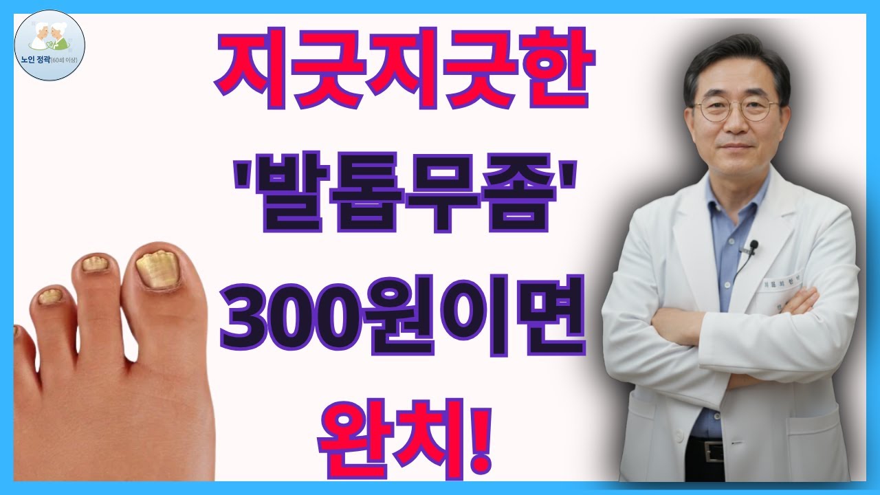 발톱 무좀이 97% 재발하는 이유 | 300원으로 뿌리 뽑는 비법