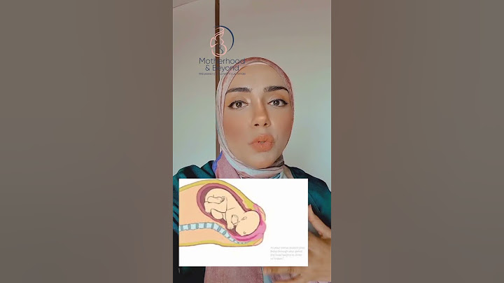 أشهر الأسباب لتعسر الولادة الطبيعية وطول فترة المخاض