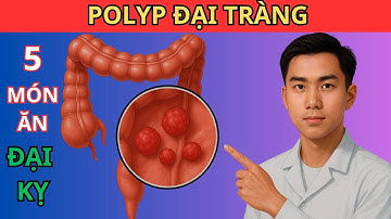 Có Polyp Đại Tràng Ăn Gì, Kiêng Gì Để Không Hóa Ung Thư?