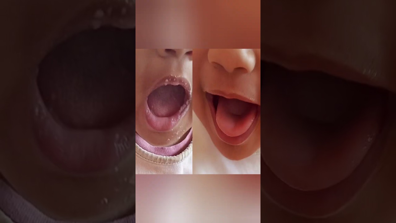 Baby silicone finger brush 🐥🌷