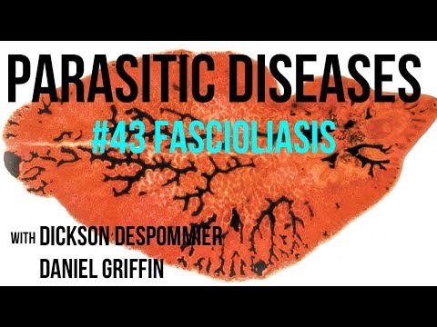 Parasitic Diseases Lectures 43: Fascioliasis