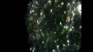 Demonstration microscope Novel analyse de semence élevage insemination