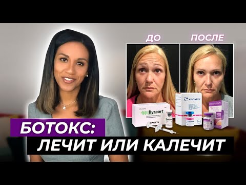 BOTOX //Как убрать морщины лба, морщины межбровья и "гусиные лапки" // Ботокс от морщин: за и против