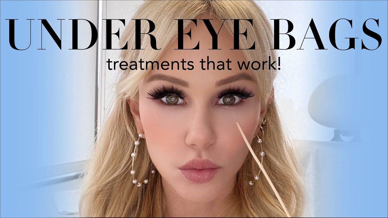 Get rid of your UNDER EYE BAGS! Treatments that WORK! YouTube