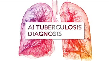 Can Artificial Intelligence Detect Tuberculosis?