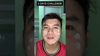 DR. WONGS SULFUR SOAP & BIODERM OINTMENT 2 DAYS CHALLENGE #DrWongs #skincare #skincareroutine