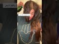 اليوم جبت لكم وصفة لمنع تساقط الشعر ونموه بسرعة اليوم جبت لكم وصفة لمنع تساقط الشعر ونموه بسرعة