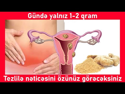 Zəncəfilin Faydaları Nələrdir?