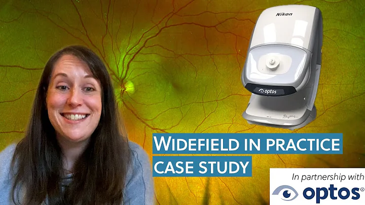 Ultrawidefield in practice | Case study | Judith L...