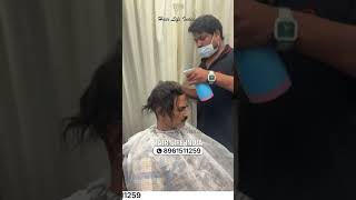 Non-Surgical Hair Replacement Before & After | Complete Hair Transformation | Hair Life India